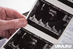 Почетный юрист РФ: платные аборты приведут к инвалидизации женщин