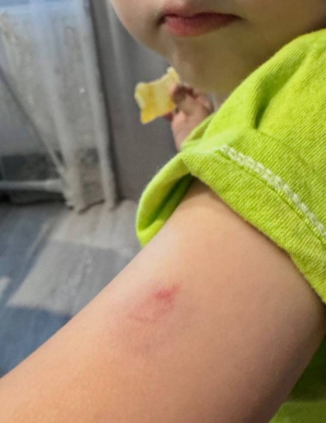 В Перми мама малыша заявила о жестоком обращении в частном детском саду. Фото, видео